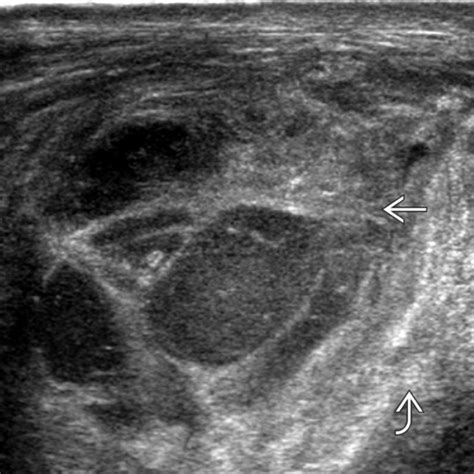 Soft Tissue Infection Radiology Key