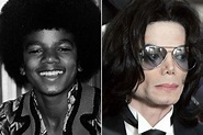 The Unforgettable Michael Jackson Before and After Plastic Surgery ...