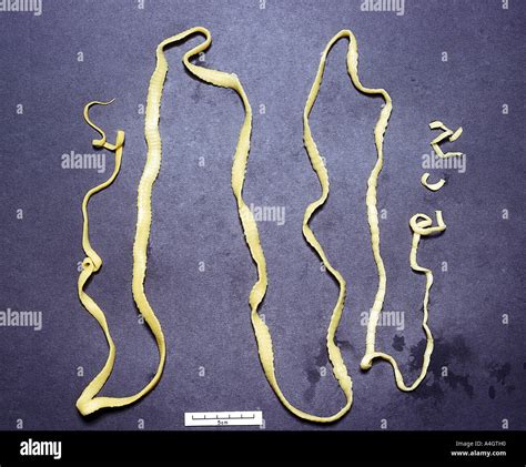 A Photograph Of The Taenia Tapeworm Stock Photo 6312463 Alamy