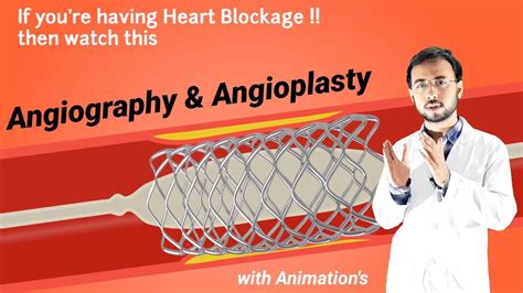 Angiography And Angioplasty Procedure Animation Angiography Kaise Hota