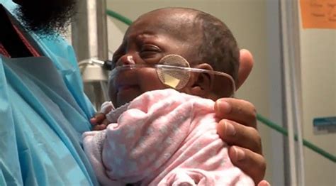 One Of The Smallest Surviving Babies In The World 10 Ounce Elayah