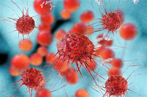 Cervical Cancer Breakthrough Major New Clue To Better Understanding The Disease