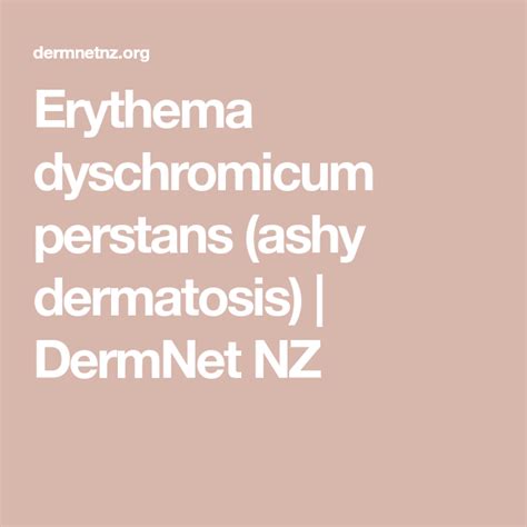 Erythema Dyschromicum Perstans Ashy Dermatosis Dermnet Nz Disease