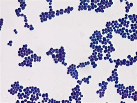 Gram Positive Rods In Chains