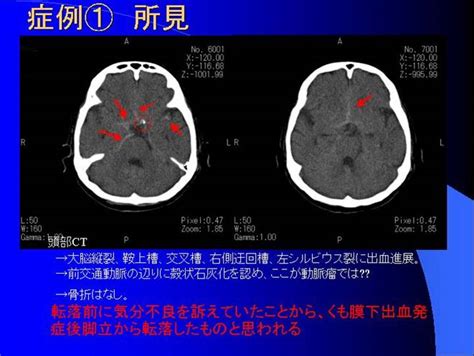 비탄의 망령은 은퇴하고싶다 1권 선탈주. ETRT（山の勉強会・20FY）