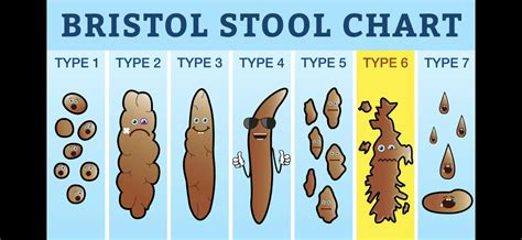 Bristol Stool Chart Real