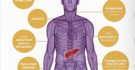 Spotting The Symptoms Of Pancreatic Cancer