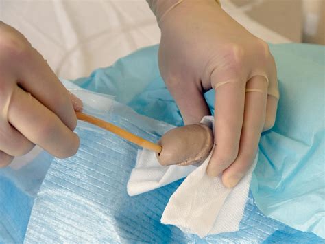 Urethral Catheterisation Male Faculty Of Medicine
