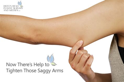 Now Theres Help To Tighten Those Saggy Arms
