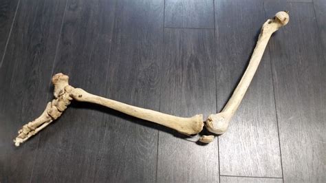 Articulated Leg And Foot Real Human Bone Medical