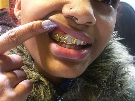 Gold Open Face Top Grillz For Girls Grills Teeth Gold Teeth Grills