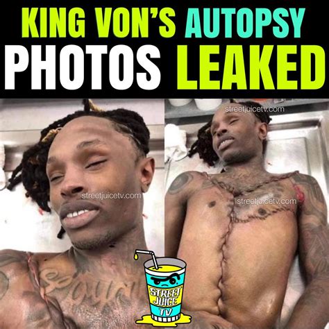 King Von Autopsy Photo Twitter Bahia Haha
