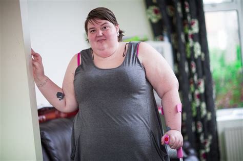 Morbidly Obese Woman Who Asked Strangers To Fund £10k Gastric Bypass