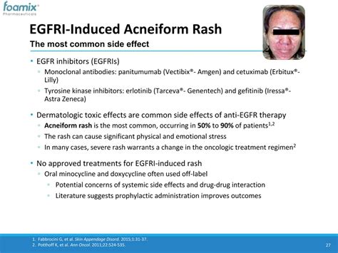 Fdx104 Topical Doxycycline Foam For Management Of Acne Like Egfri