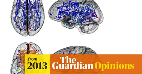 So Men And Womens Brains Are Wired Differently But Its Not That