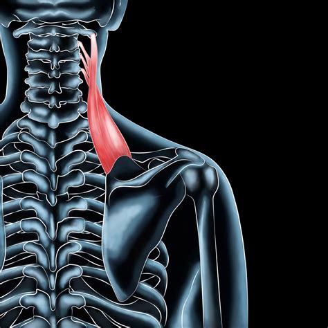 Levator Scapulae Muscle Recovery Shoulder Pain Solutions