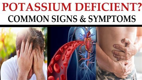 how to recognize these signs and symptoms of potassium deficiency dr a signs and symptoms