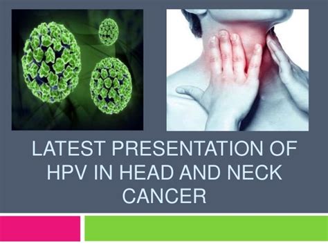 Latest Presentation Of Hpv In Head And Neck