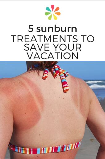 5 Sunburn Treatments To Save Your Vacation Everyday Health Sunburn