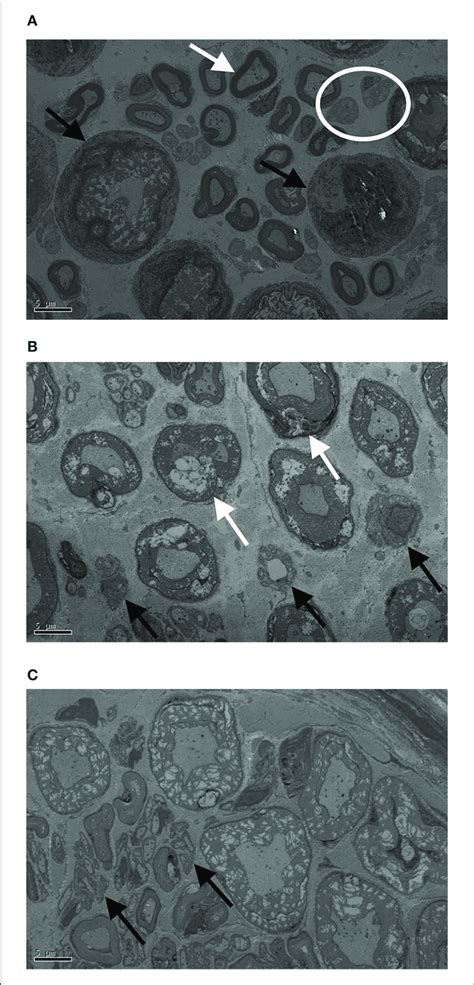 Transmission Electron Microscopy Tem Images Of Proximal Ulnar A
