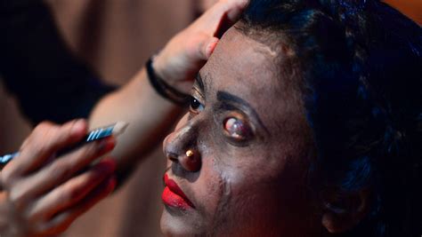 Why Acid Attacks Are On The Rise In Britain