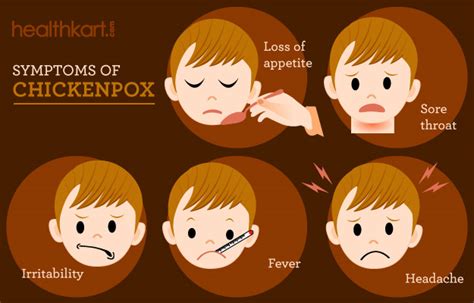 How To Identify The Symptoms Of Chickenpox Healthkart
