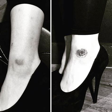 Clever Tattoo Designs That Turn Scars Into Beautiful Works Of Art
