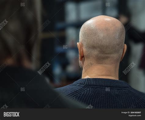 Back View Man Bald Image And Photo Free Trial Bigstock