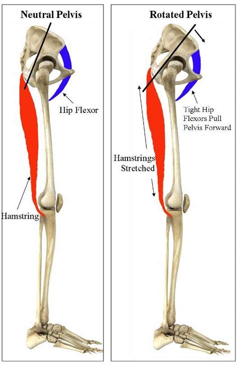 Those are muscles that are attached mainly to the femur and the hip bones. Training To Prevent Hamstring Injuries » Movement as Medicine