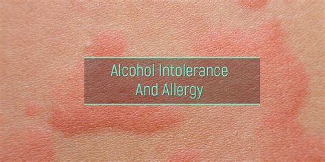 Alcohol Allergy And Intolerance Rash Hives And Other Symptoms