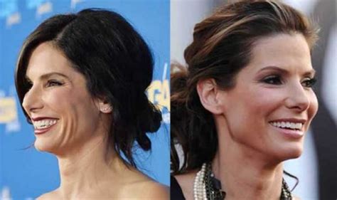 Sandra Bullock Plastic Surgery Nose Job Facelift Botox