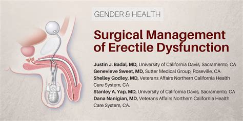 Surgical Management Of Erectile Dysfunction Healthplexus Net