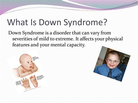 Ppt Down Syndrome 7 6 Powerpoint Presentation Free Download Id2359700