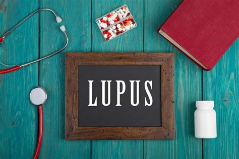 Spreading The Word About Lupus Lupus Symptoms Healthyu