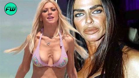 Celebrities Before And After Plastic Surgery Disasters