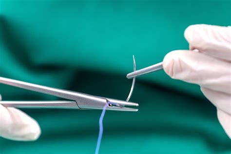 Why Its Important To Remove The Sutures You Place Suture Material