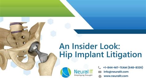An Insider Look Hip Implant Litigation Ppt