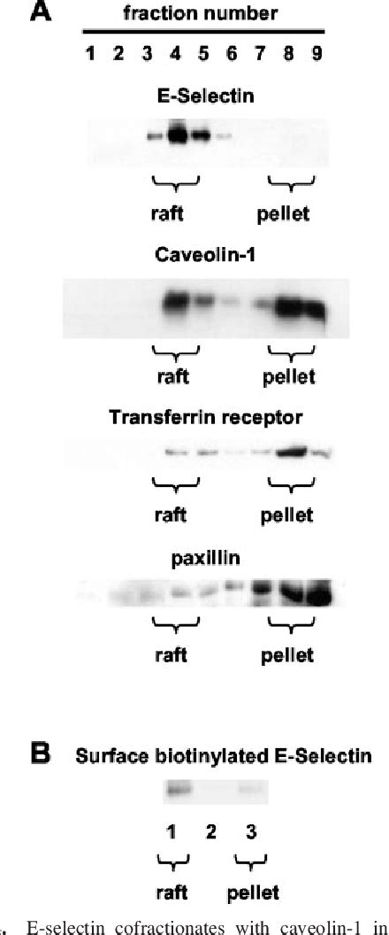 Figure From Lipid Raft Localization Of Cell Surface E Selectin Is