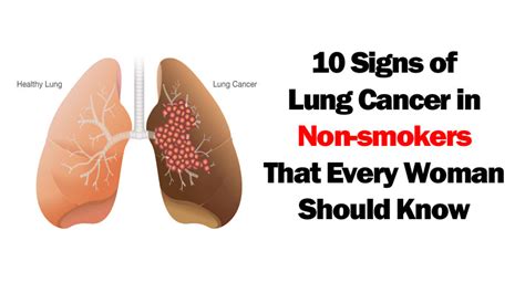 10 Signs Of Lung Cancer In Non Smokers That Every Woman Should Know