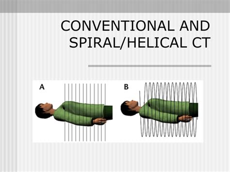 Single Slice Spiralhelical Ct