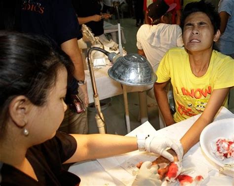 More Firecracker Casualties This Year Number Still Rising—doh