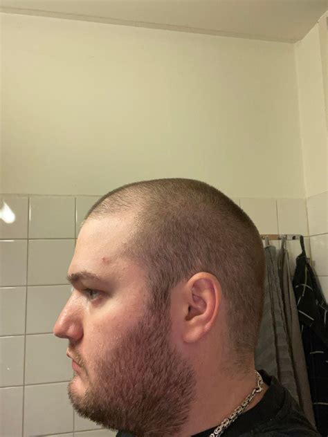 ever since i went bald my sex life disappeared r bald