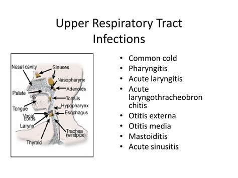 Ppt Upper Respiratory Tract Infections And Influenza Powerpoint