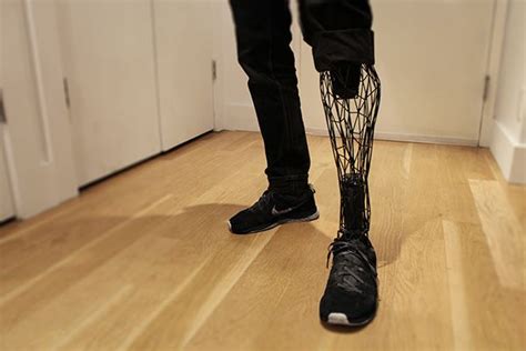 Exo 3d Printed Titanium Prosthetic Leg Prosthetic Leg 3d Printing