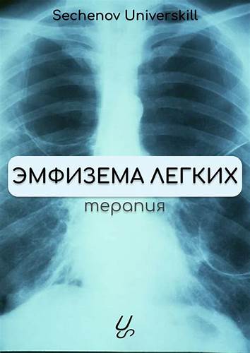 Эмфизема легких диета Эмфизема легких | Александр Сеченов из медицинской онлайн школы Эмфизема легких | Александр Сеченов из медицинской онлайн школы Эмфизема легких диета