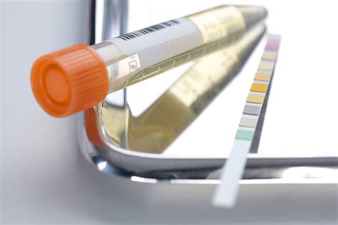 Incident Proteinuria in SLE May Be Predicted by Certain Clinical ...