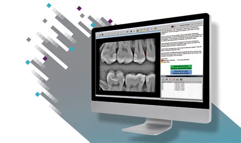 Logicon Caries Detector Software