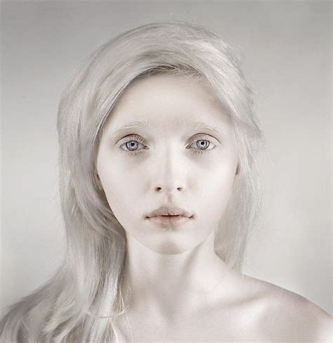 Nastya Kumarova An Albino Girl From Russia Albino Model Albino Girl Albino Human