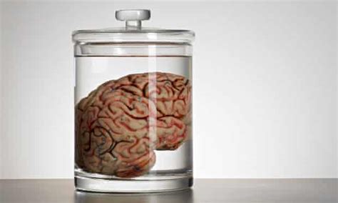 The Baffling Case Of The 100 Missing Brains Biology The Guardian