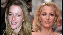 Gillian Anderson Plastic Surgery Before and After Photos - YouTube